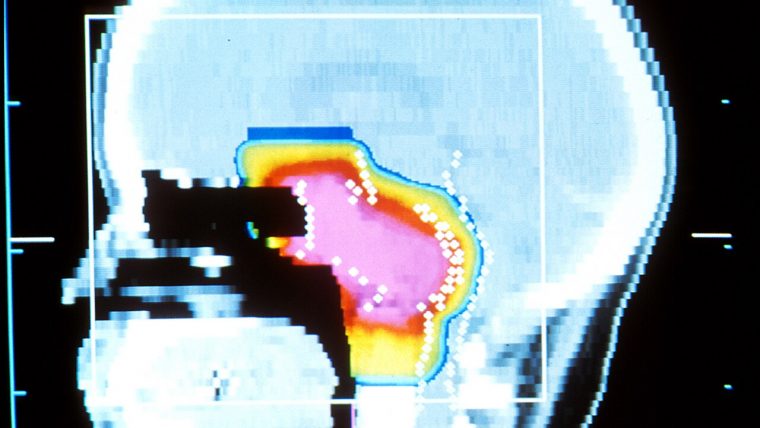 Acceleratore per adroterapia