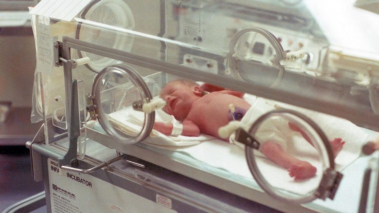 Neonato prematuro in incubatrice