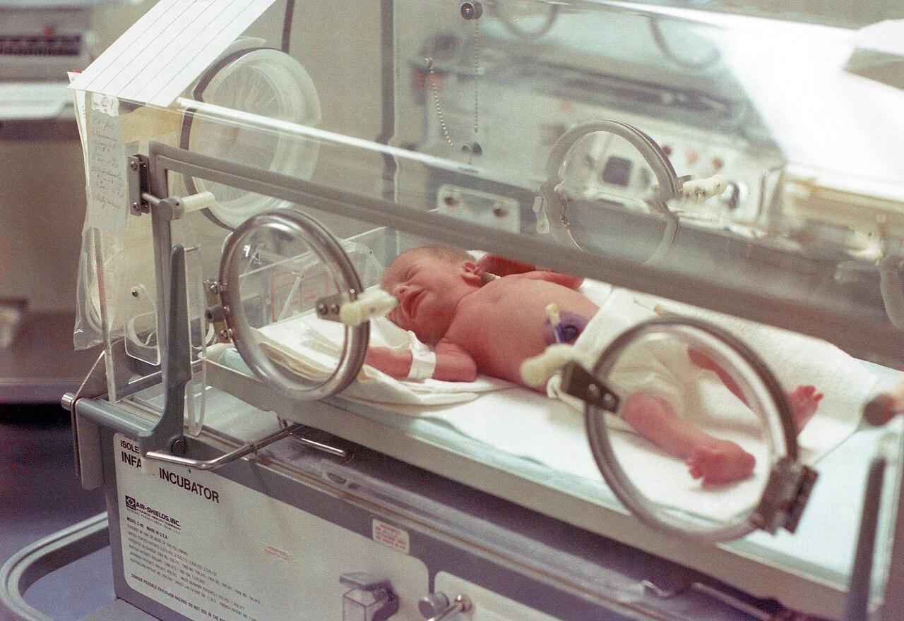 Neonato prematuro in incubatrice