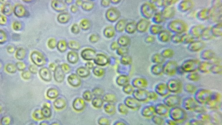 Candida al microscopio