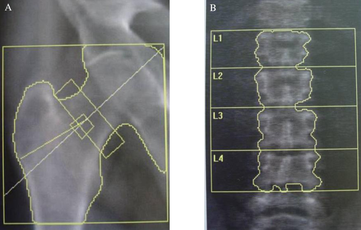 Radiografia della colonna