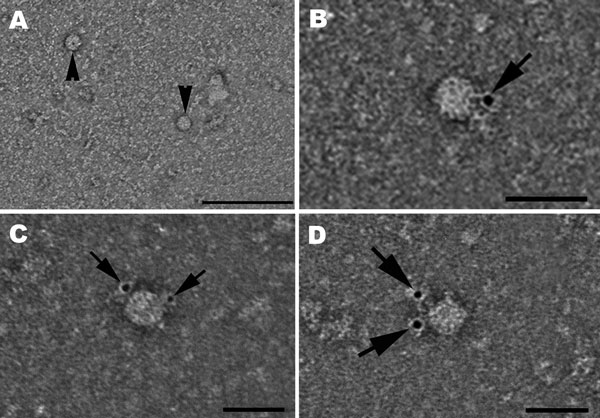 Virus dell'epatite