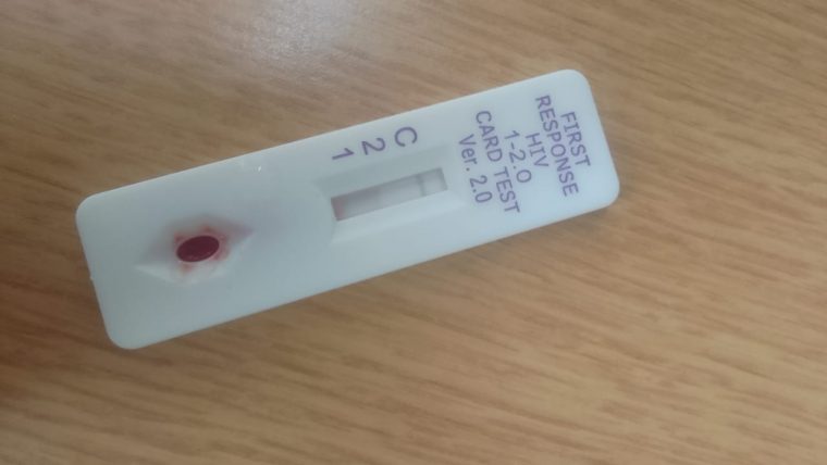Autotest per l'HIV