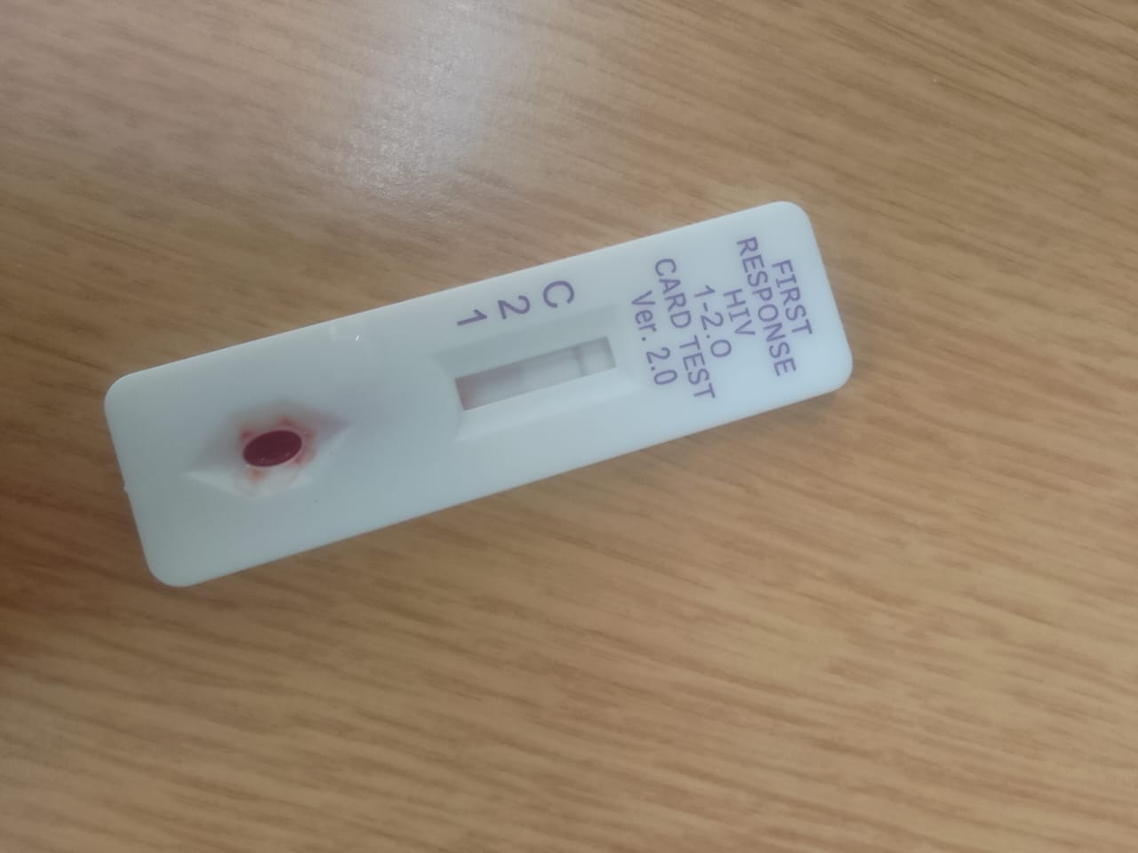 Autotest per l'HIV