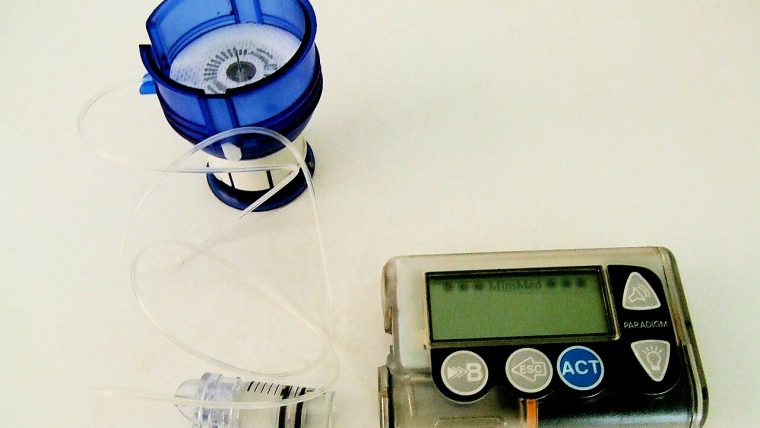 Microinfusore di insulina