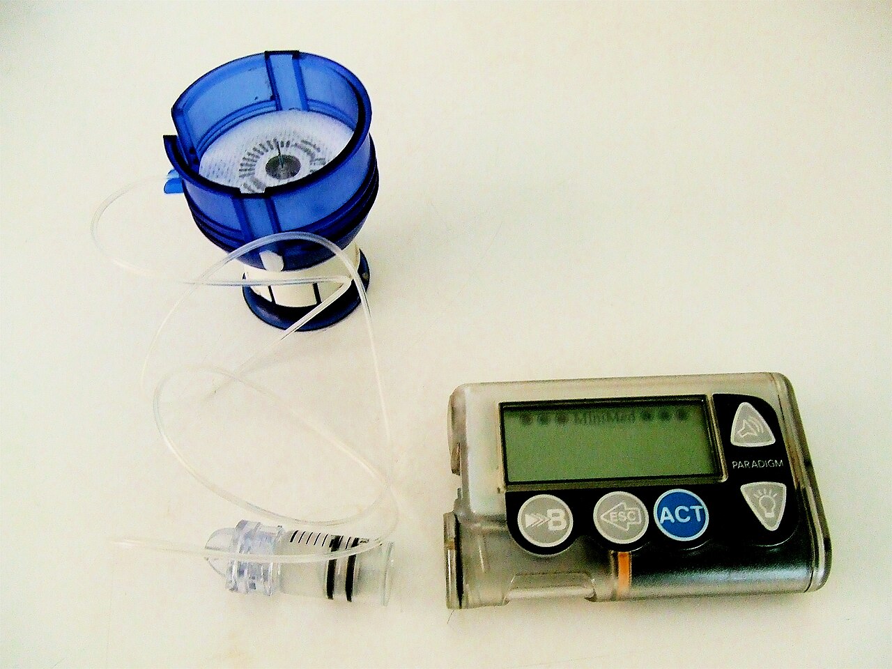 Microinfusore di insulina