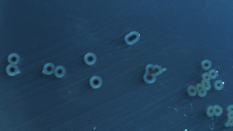 Batteri della salmonella