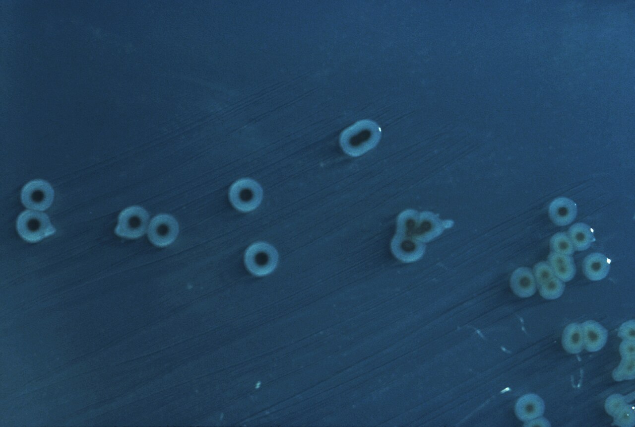 Batteri della salmonella