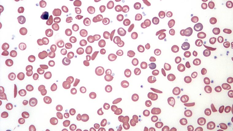 Globuli rossi al microscopio