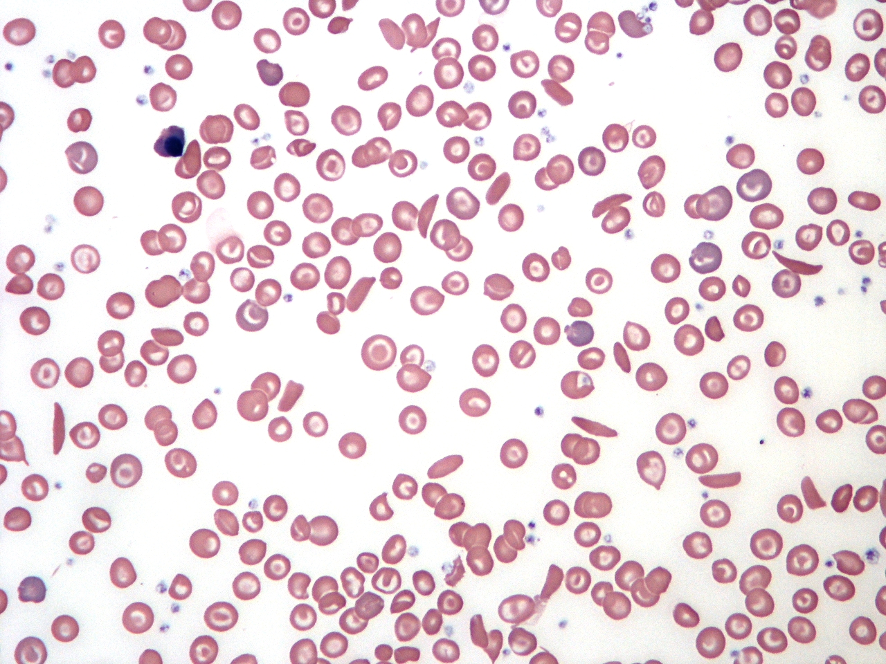 Globuli rossi al microscopio