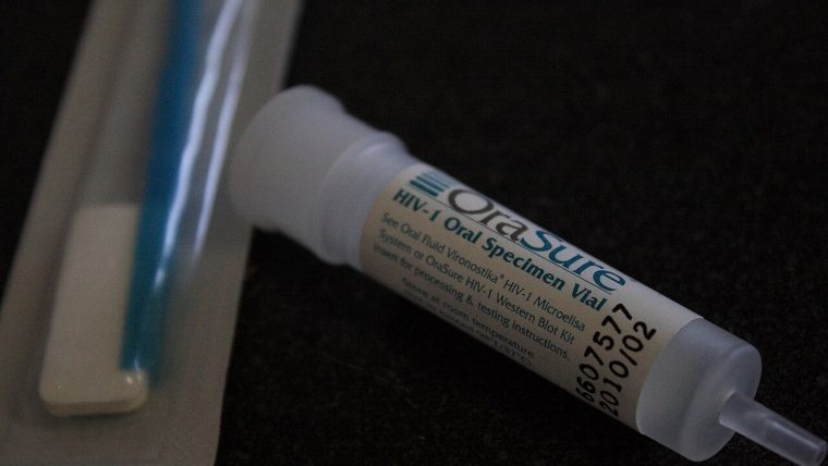Test rapido per l'HIV