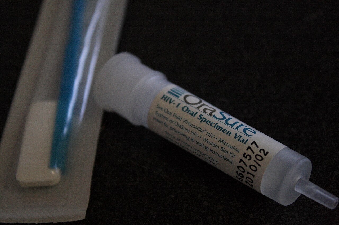 Test rapido per l'HIV